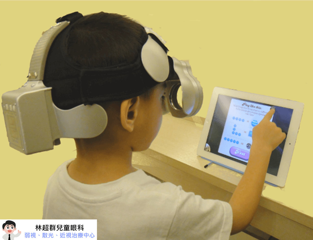 兒童散光,散光檢測,散光治療